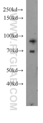 HPS4 Antibody in Western Blot (WB)