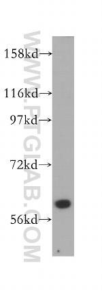 ABCB10 Antibody in Western Blot (WB)