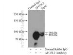 AFG3L2 Antibody in Immunoprecipitation (IP)