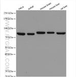 AFG3L2 Antibody in Western Blot (WB)