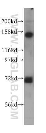 SIN3A Antibody in Western Blot (WB)