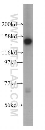 SIN3A Antibody in Western Blot (WB)