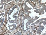 REEP5 Antibody in Immunohistochemistry (Paraffin) (IHC (P))