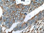 REEP5 Antibody in Immunohistochemistry (Paraffin) (IHC (P))