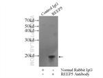 REEP5 Antibody in Immunoprecipitation (IP)