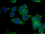 RDH10 Antibody in Immunocytochemistry (ICC/IF)