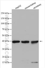 RDH10 Antibody in Western Blot (WB)