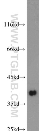 RDH10 Antibody in Western Blot (WB)