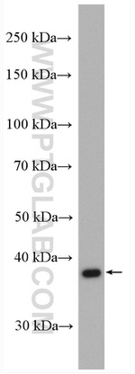 RDH10 Antibody in Western Blot (WB)