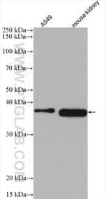 RDH10 Antibody in Western Blot (WB)