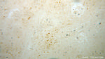 BIN1 Antibody in Immunohistochemistry (Paraffin) (IHC (P))