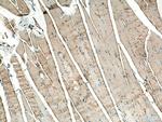 BIN1 Antibody in Immunohistochemistry (Paraffin) (IHC (P))