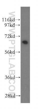 BIN1 Antibody in Western Blot (WB)