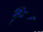 NCF4 Antibody in Immunocytochemistry (ICC/IF)