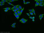 RPL18A Antibody in Immunocytochemistry (ICC/IF)