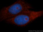 RPL18A Antibody in Immunocytochemistry (ICC/IF)