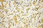 RPL18A Antibody in Immunohistochemistry (Paraffin) (IHC (P))