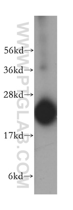 RPL18A Antibody in Western Blot (WB)