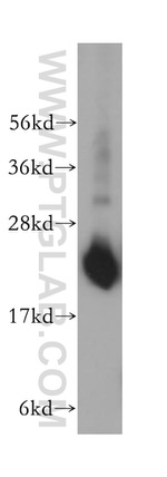 RPL18A Antibody in Western Blot (WB)