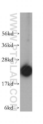 RPL18A Antibody in Western Blot (WB)