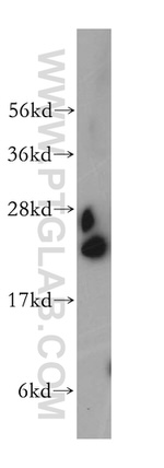 RPL18A Antibody in Western Blot (WB)