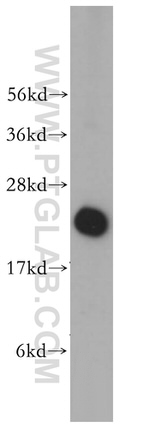 RPL18A Antibody in Western Blot (WB)