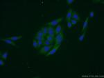 EIF1AX Antibody in Immunocytochemistry (ICC/IF)