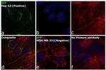 alpha-Fetoprotein Antibody