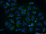RPL37A Antibody in Immunocytochemistry (ICC/IF)