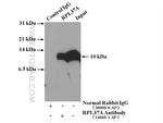 RPL37A Antibody in Immunoprecipitation (IP)