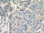 PHLDA2 Antibody in Immunohistochemistry (Paraffin) (IHC (P))