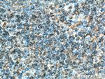 HLA-F Antibody in Immunohistochemistry (Paraffin) (IHC (P))