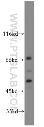 SEPT11 Antibody in Western Blot (WB)