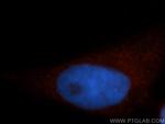 SEPT11 Antibody in Immunocytochemistry (ICC/IF)