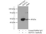 SEPT11 Antibody in Immunoprecipitation (IP)