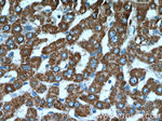 ADHFE1 Antibody in Immunohistochemistry (Paraffin) (IHC (P))