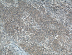 ADHFE1 Antibody in Immunohistochemistry (Paraffin) (IHC (P))