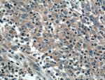 ADHFE1 Antibody in Immunohistochemistry (Paraffin) (IHC (P))