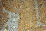 ADHFE1 Antibody in Immunohistochemistry (Paraffin) (IHC (P))