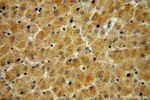 ADHFE1 Antibody in Immunohistochemistry (Paraffin) (IHC (P))