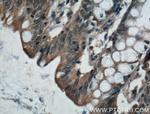 ADHFE1 Antibody in Immunohistochemistry (Paraffin) (IHC (P))