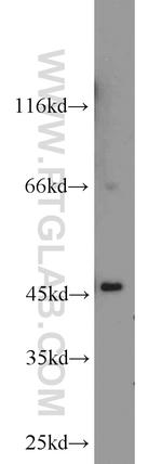 ADHFE1 Antibody in Western Blot (WB)