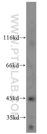 ADHFE1 Antibody in Western Blot (WB)