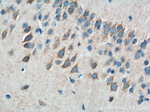 ATP5A1 Antibody in Immunohistochemistry (Paraffin) (IHC (P))