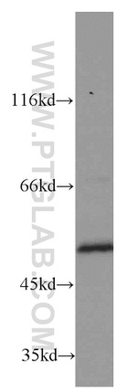 ATP5A1 Antibody in Western Blot (WB)