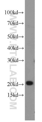 MRPL48 Antibody in Western Blot (WB)