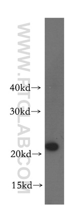 MRPL48 Antibody in Western Blot (WB)