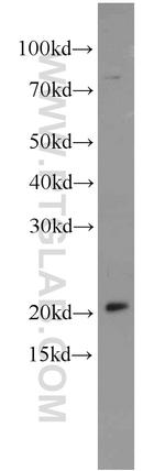 MRPL48 Antibody in Western Blot (WB)