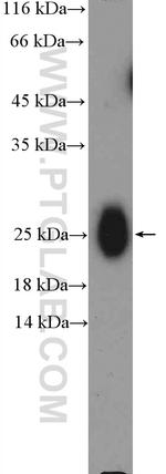 IgG light chain (Kappa) Antibody in Western Blot (WB)