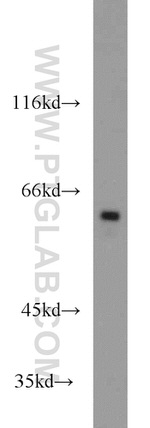 MTA3 Antibody in Western Blot (WB)